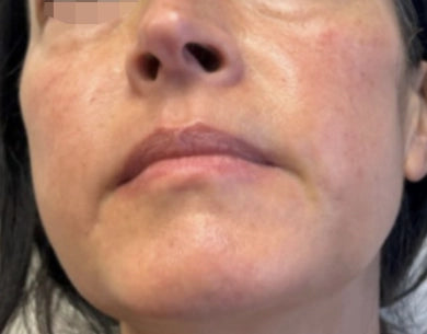 ION* Skin Support backed by results