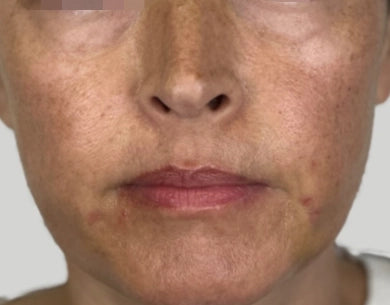 ION* Skin Support backed by results