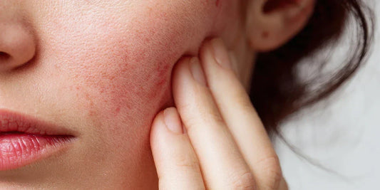 Skin Health: Strengthen Your Barrier from the Outside In