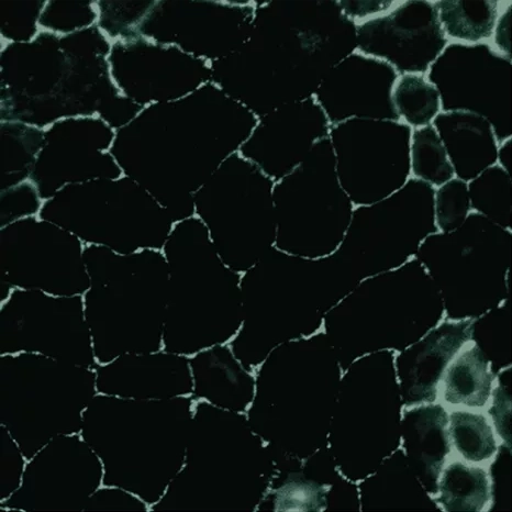 Gut lining compromised by glyphosate