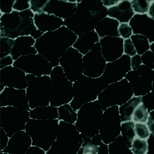 Image of microscopic cells that have been damaged from glyphosate.
